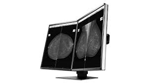 EIZO - monitor medicale - GX560