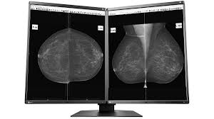 EIZO - monitor medicale - GX560MD