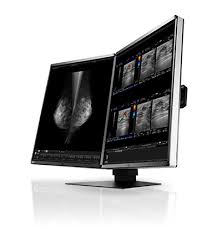 EIZO - monitor medicale - RX560
