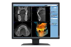 EIZO - monitor medicale - MX217-SB