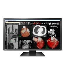 EIZO - monitor medicale - MX317W